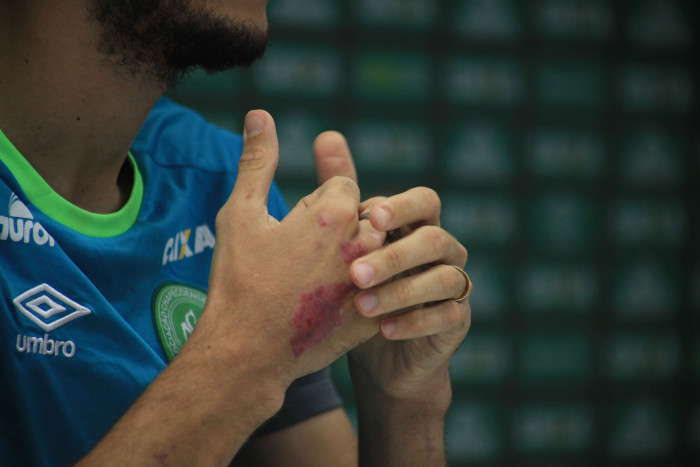 Chapecoense | Flickr