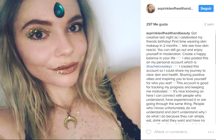 El antes y el después de una joven que sufría de acné: ahora es inspiración para muchas mujeres - Imagen 3