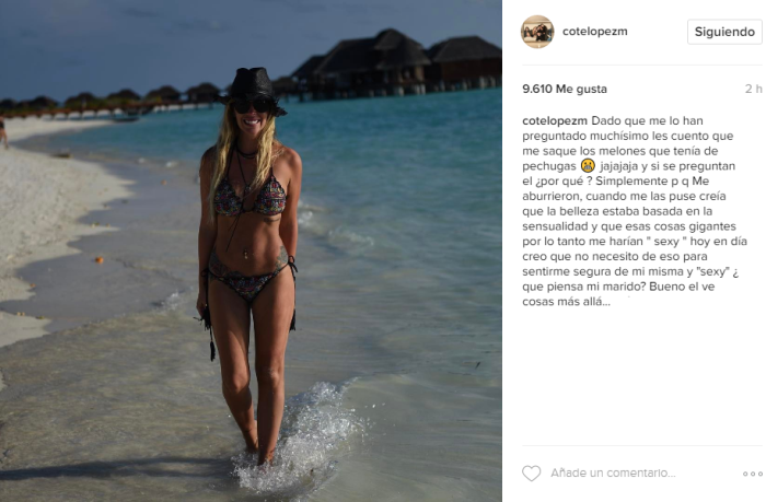 Cote López, 100% natural: se sacó los implantes mamarios - Imagen 4