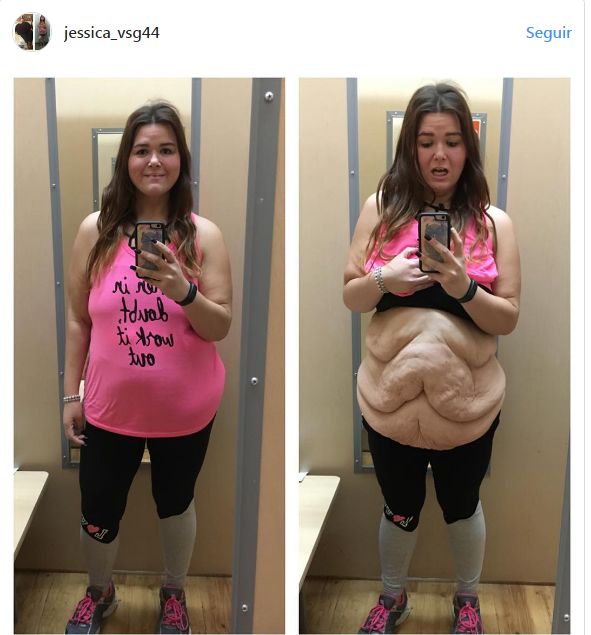 Joven muestra cruda realidad tras bajar más de 80 kilos Joven muestra cruda realidad tras bajar más de 80 kilos