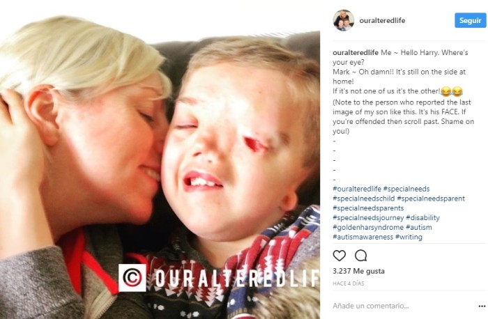 Our Altered Life | Instagram