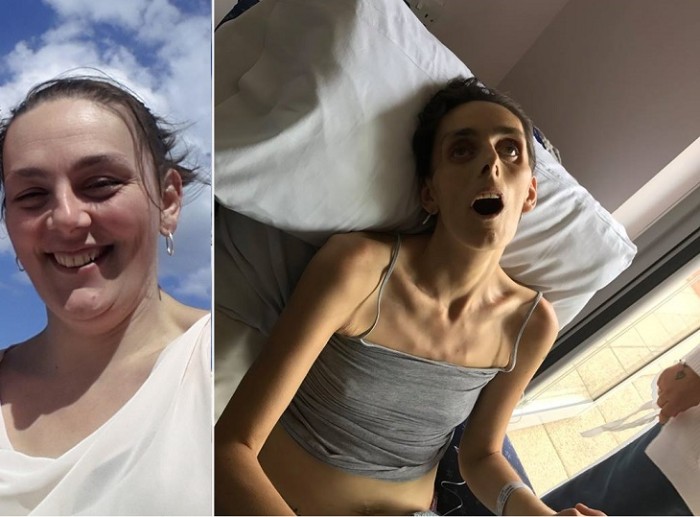 Donna antes y después de la enfermedad | Facebook