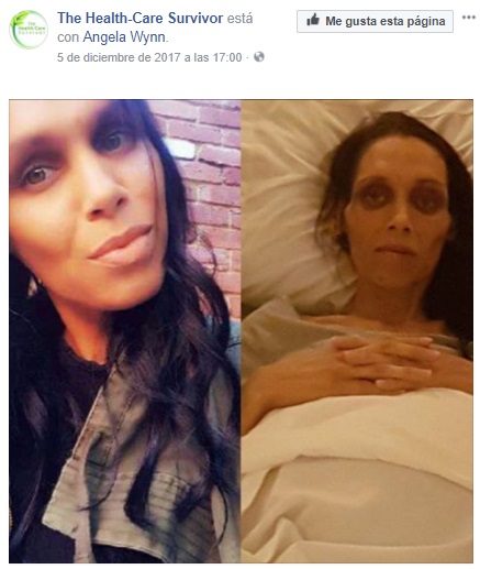 Nicole antes y después de ser diagnosticada de cáncer