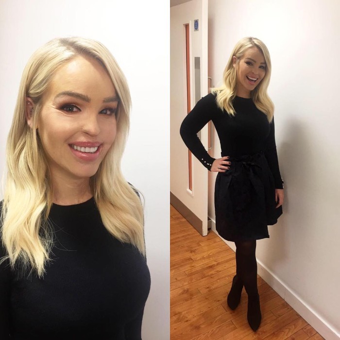 Katie Piper | Instagram