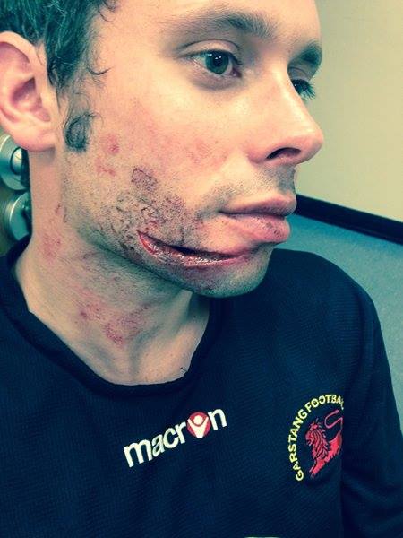 Garstang FC | Oficial