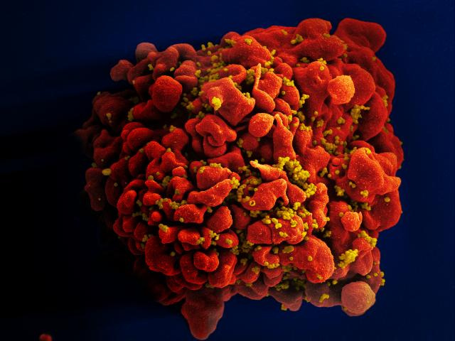 Así luce una célula infectada |NIAID (cc) | Flickr