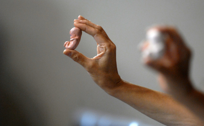 Concepción: Sujetos destruyen imágenes sobre aborto montadas en un camión