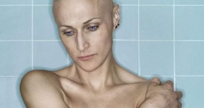 Muertes por cáncer se triplican en Chile: Conoce los tipos más frecuentes según género