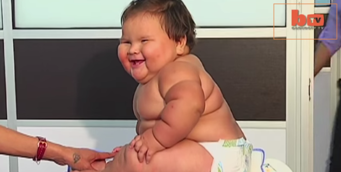 La bebé colombiana de 10 meses que pesa lo mismo que una niña de 5 años