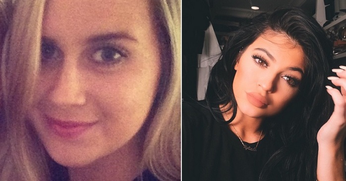 Joven australiana quería los labios de las Kardashian: Así de mal resultó