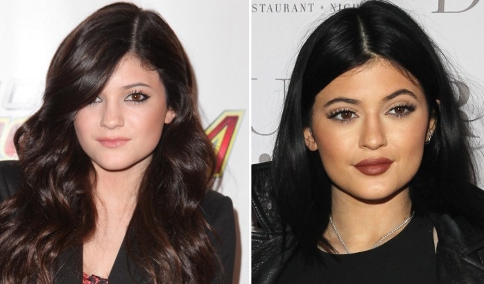Antes y después de Kylie | AFP