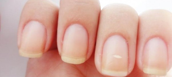La razón de por qué aparecen manchas blancas en nuestras uñas