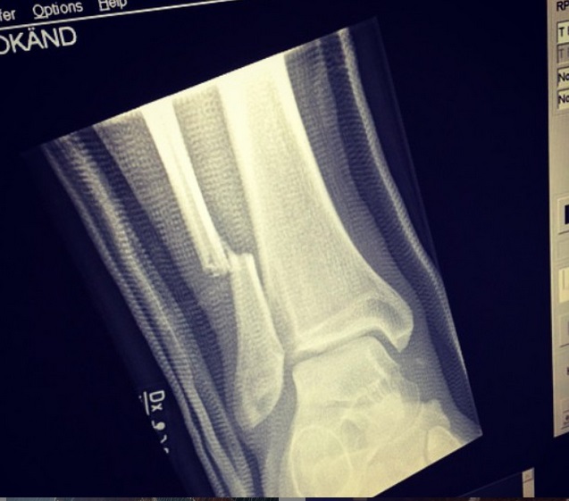 Foo Fighters | Instagram