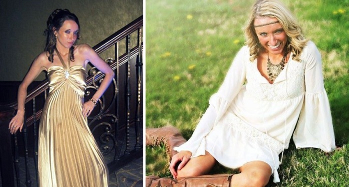 El crudo relato de joven que sufrió un infarto a los 17 años por ejercitar en exceso