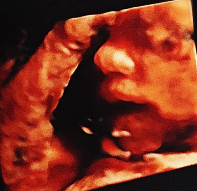 Jean Paul Pineda | Instagram