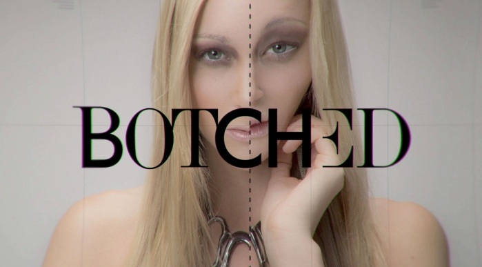 El impactante caso de la ex bailarina con implantes de senos de 13 kilos: Logró reducirlos