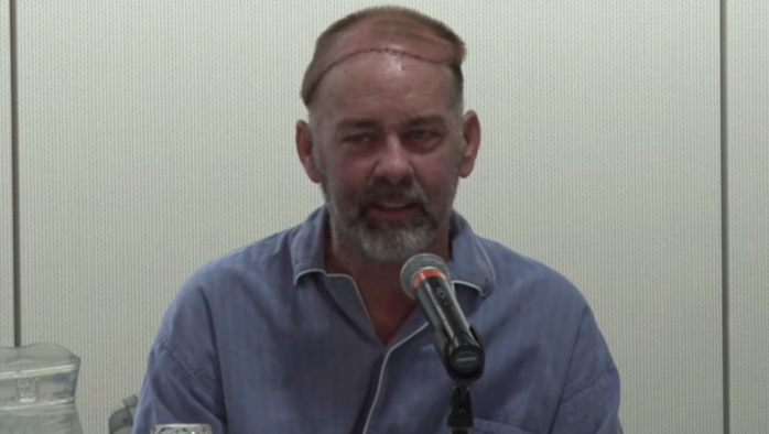 Realizan en EEUU histórico trasplante de cráneo y cuero cabelludo: Así quedó el paciente