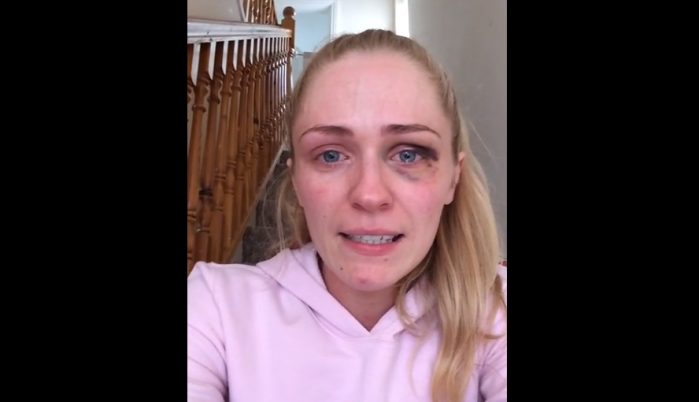 La joven madre que sacudió al mundo con su historia de violencia doméstica