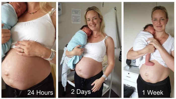 Bloguera comparte fotografías de cómo quedó su cuerpo tras dar a luz... sin retoques