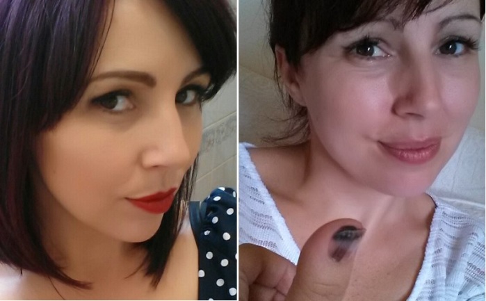 Inglesa pensó que mancha en su dedo era una infección:  Esto era realmente