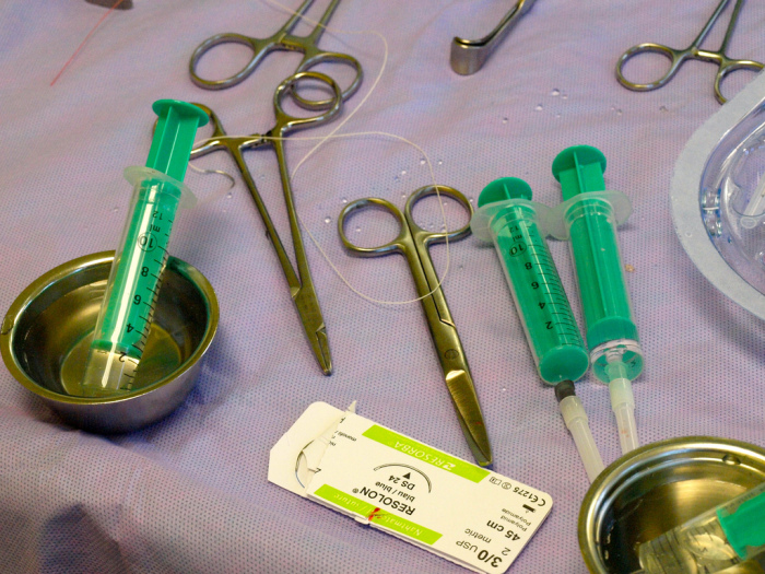 Hombre 'gringo' quiso alargar su pene con cirugía: Este fue su triste final