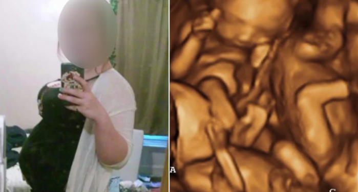 Adolescente 'gringa' fingió estar embarazada de trillizos con ayuda de web