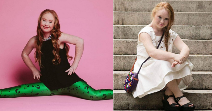Así de bella desfiló modelo con Síndrome de Down por pasarela de Nueva York