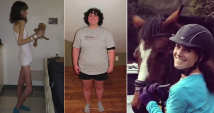 Joven pasó de los 25 a los 100 kilos luchando contra los trastornos alimentarios