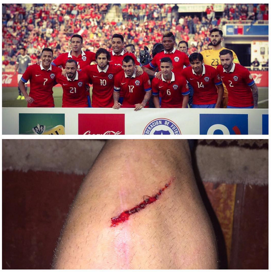 Gary Medel | Instagram