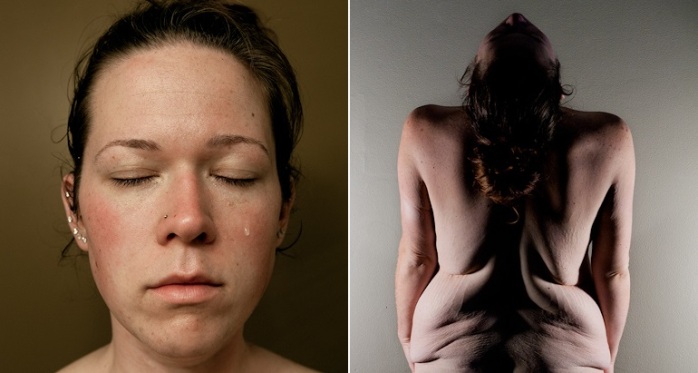 Los retratos brutalmente honestos de mujer que bajó 72 kilos: Así luce hoy