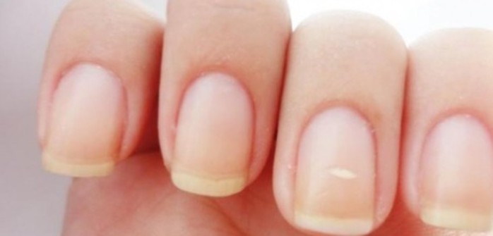 Test: Esto revela la forma de tus uñas de tu verdadera personalidad