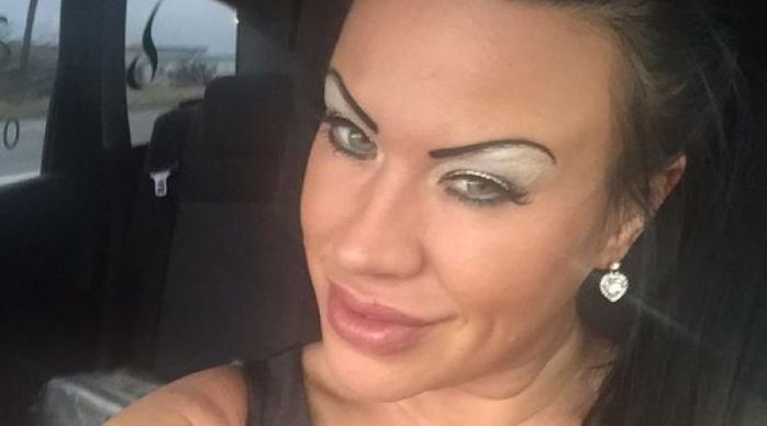 Adicta al botox sufrió fuerte caída de cara: Así quedó su 