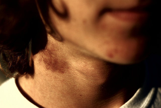 James Alby (cc) | Flickr