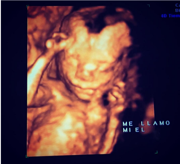 Isidora Urrejola | Instagram