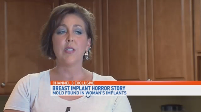 No vas a creer lo que encontraron en los implantes mamarios de esta mujer