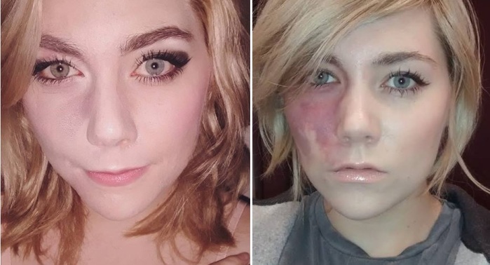 Con y sin maquillaje | Lexxie Harford