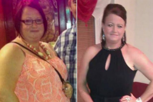 Julie antes y después | The Mirror