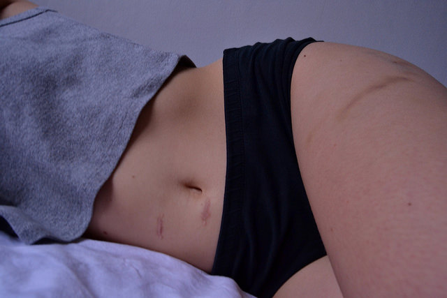 linspiration01 (cc) | Flickr