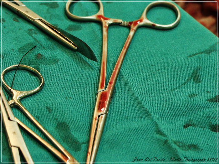 Mujeres se realizaron cirugías estéticas con 