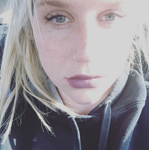 Kesha | Instagram