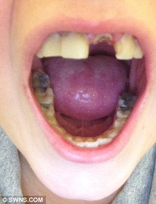 3253134000000578-3498511-Miss_Grant_s_teeth_teeth_crumble_away_when_she_sneezes_leaving_g-a-22_1458300442905