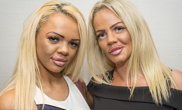 ¿Valen la pena los $60 millones que han gastado esta madre y su hija en cirugías?