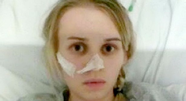 Joven con anorexia pesa 25 kilos y asegura que hasta respirar hace que suba de peso