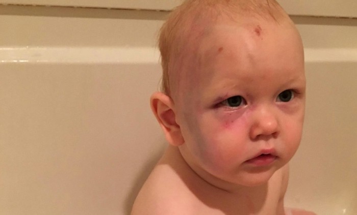 Padres de bebé supuestamente maltratado por su niñera piden justicia a través de Facebook