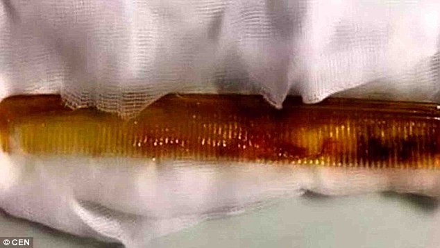 2FD5A57300000578-3386631-image-a-46_1452075817748