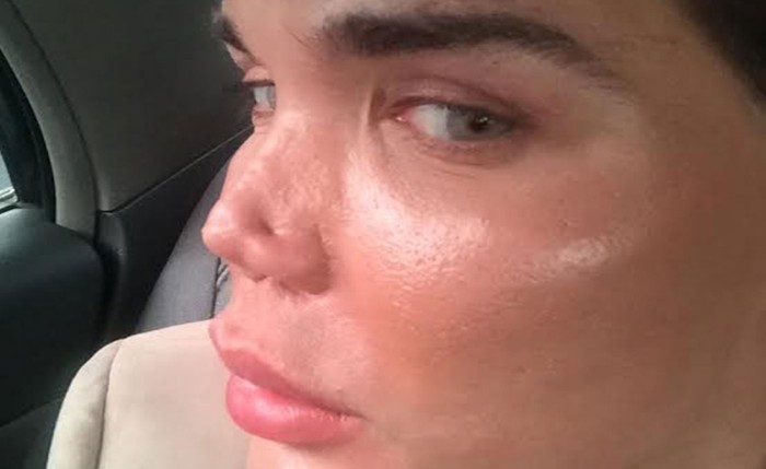 'Ken humano' recibió amenazas por acceder a cirugía a través del sistema público de salud