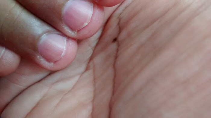 7 problemas de salud que puede provocar el mal hábito de 'comerse las uñas'