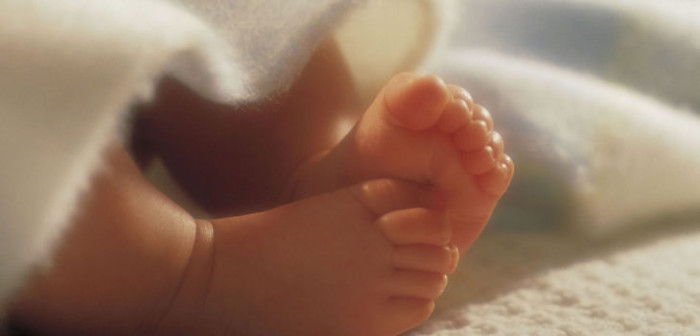 Confirman fallecimiento de siamesas unidas por el corazón en Talca