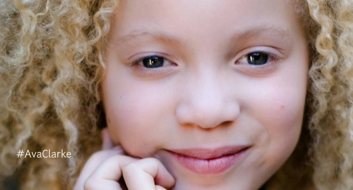 Ava Clarke: la modelo albina de 8 años que revolucionó el mundo de la moda