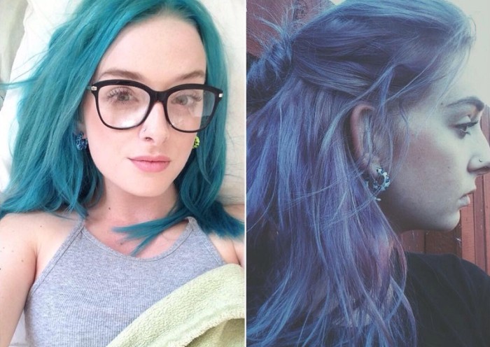 Joven fue despedida de su trabajo luego de sufrir reacción alérgica que casi la mata